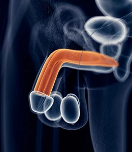 penis eğriliği tedavisi ankara urolog
