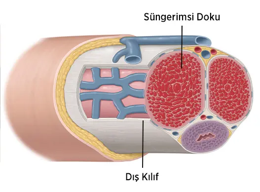 Penis eğriliği ve peyronie arasında ki fark nedir